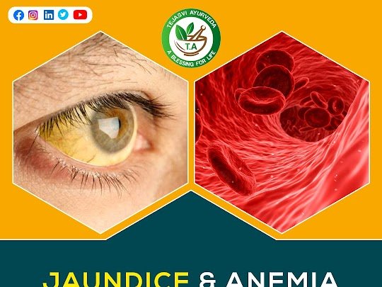 Jaundice Treatment